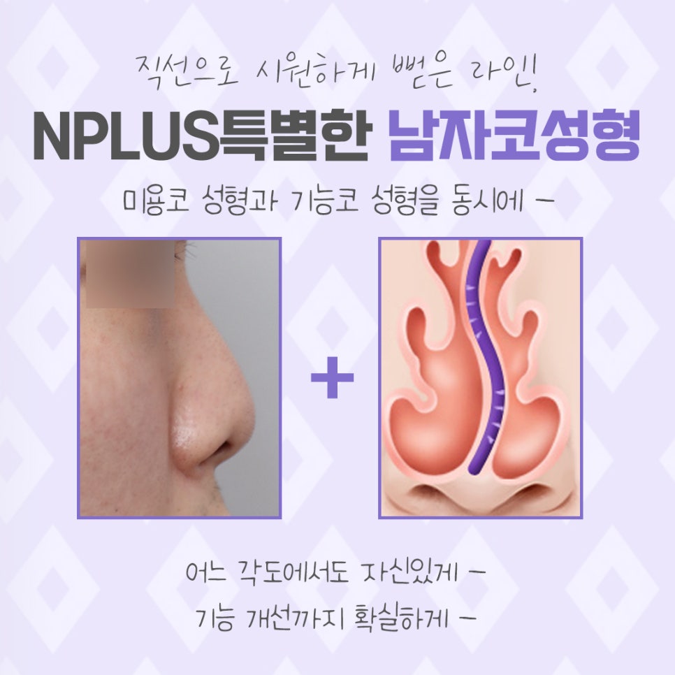 A Nose Line That Suits You, Even in Men's Rhinoplasty Reviews image 4