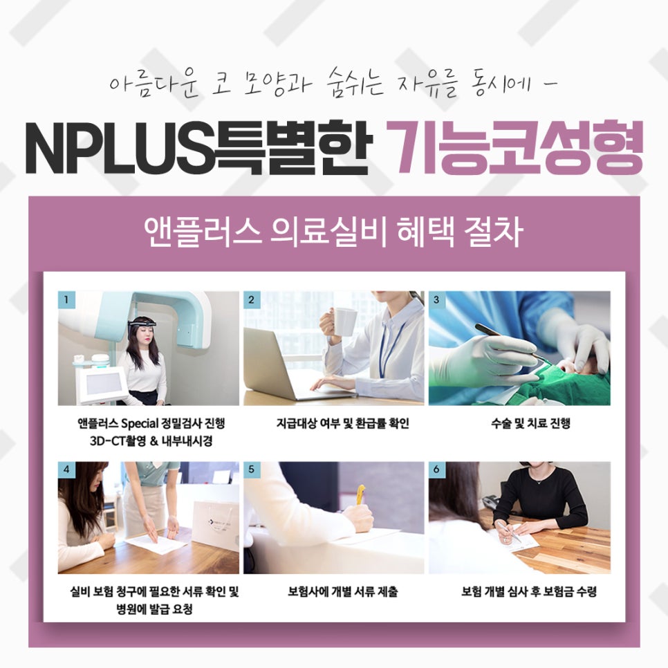 코성형실비를 알아보고 결정 관련 이미지 9