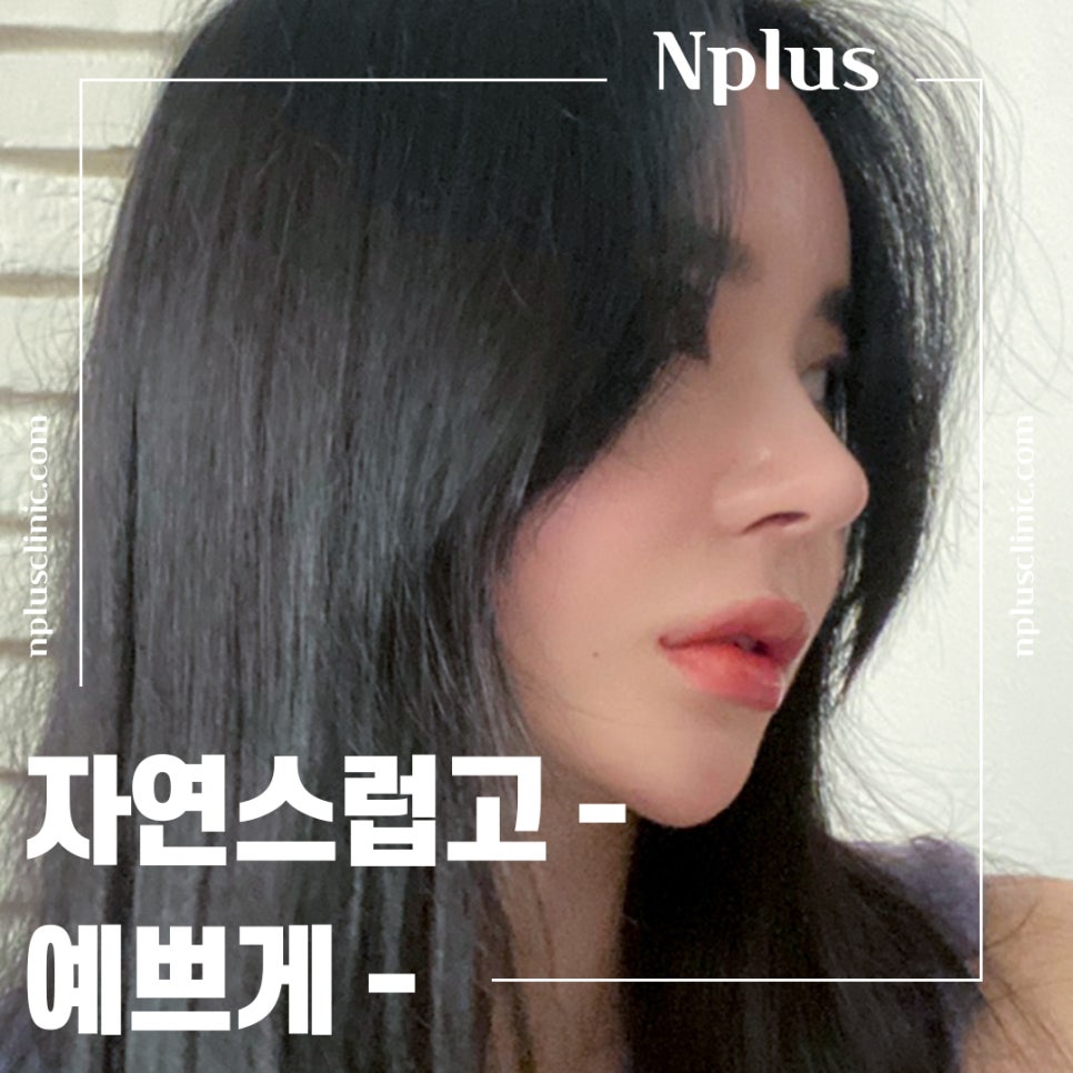 Carefully Looking Into Seoul Nose Revision Surgery image 2