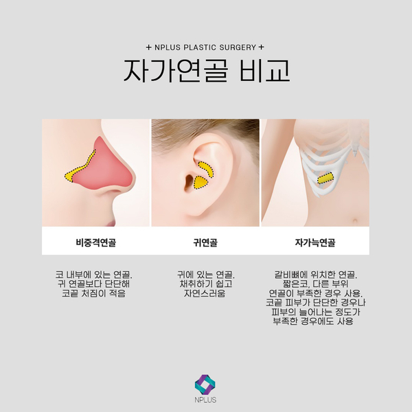 무보형물 코수술 자연스러운 코끝성형 관련 이미지 2
