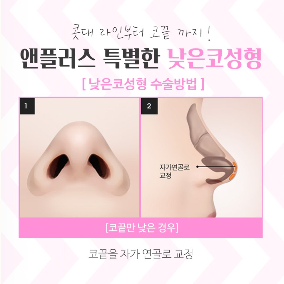 낮은코수술후기 확인하고 예쁜 라인으로 관련 이미지 9