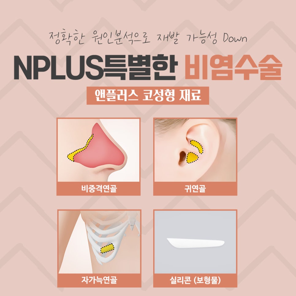 비중격수술후기 정확하게 파악해야 관련 이미지 12