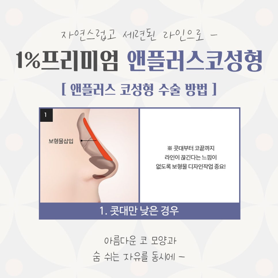 자가늑연골코성형으로 자연스럽지만 화려한 코 라인! 관련 이미지 7