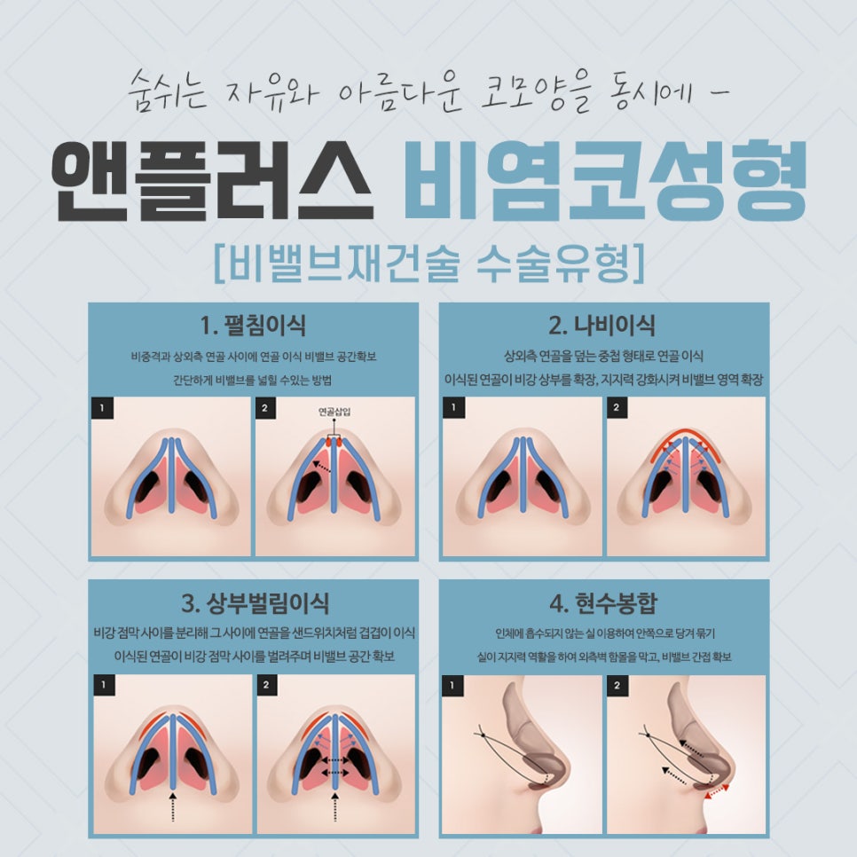비염코성형후기 원인을 자세하게 알아보고 관련 이미지 8