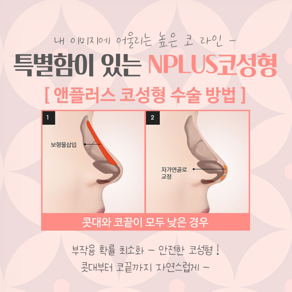 코수술 후기까지 확인하여 세련된 코라인으로 관련 이미지 8