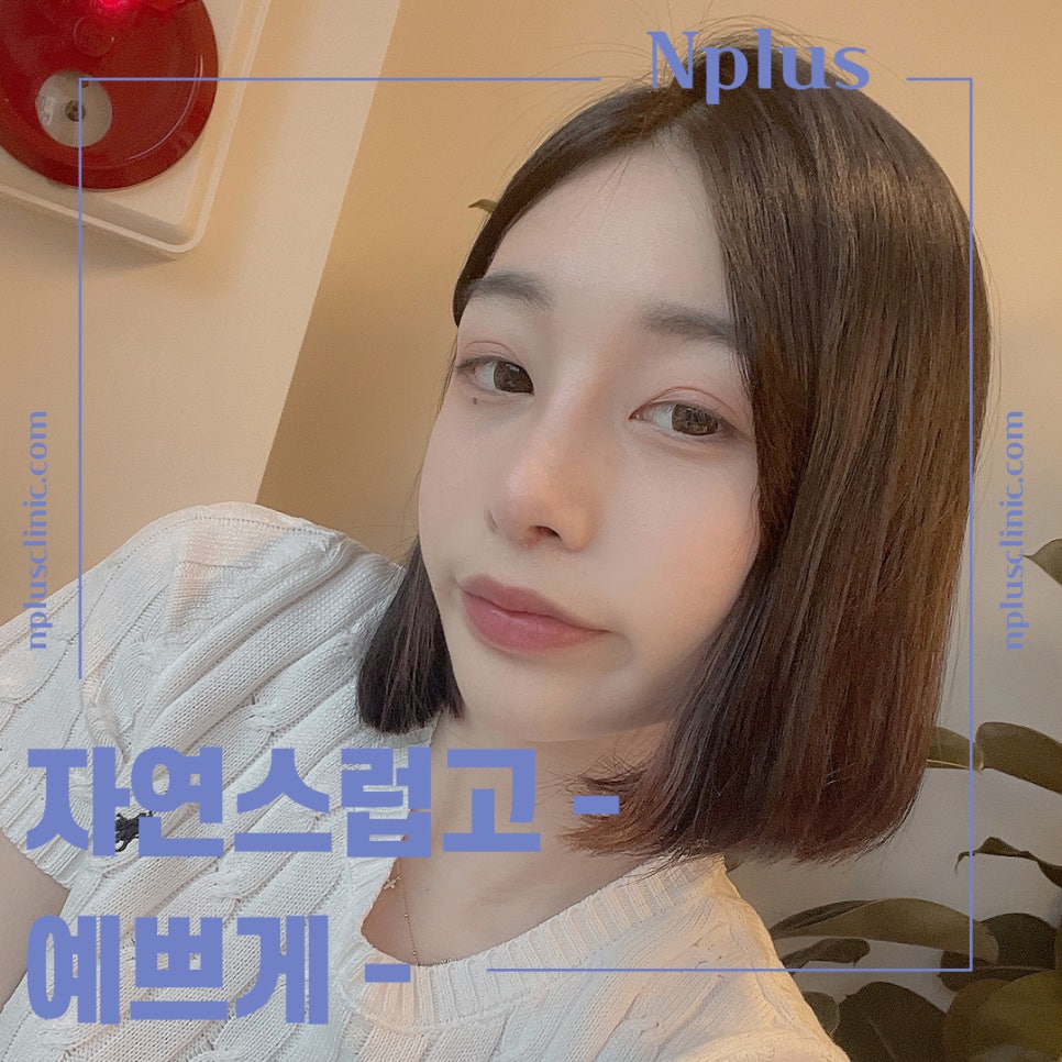 Post-Operative Review of Bulbous Nose Surgery, Improved Naturally image 6