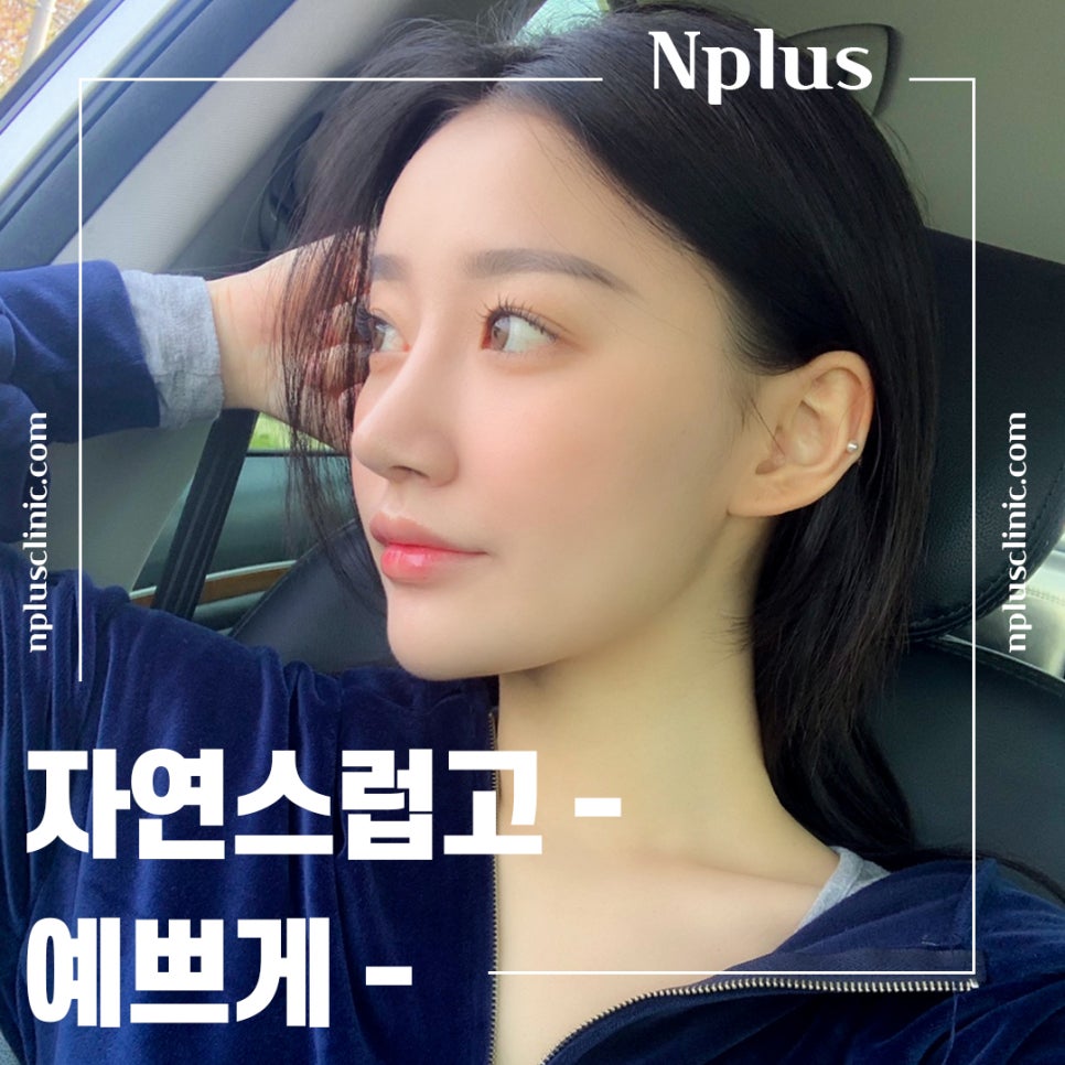 Significantly Improve an Upturned Nose with Surgery image 1