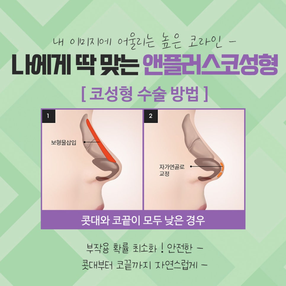 Check the Difference Before and After Rhinoplasty image 7