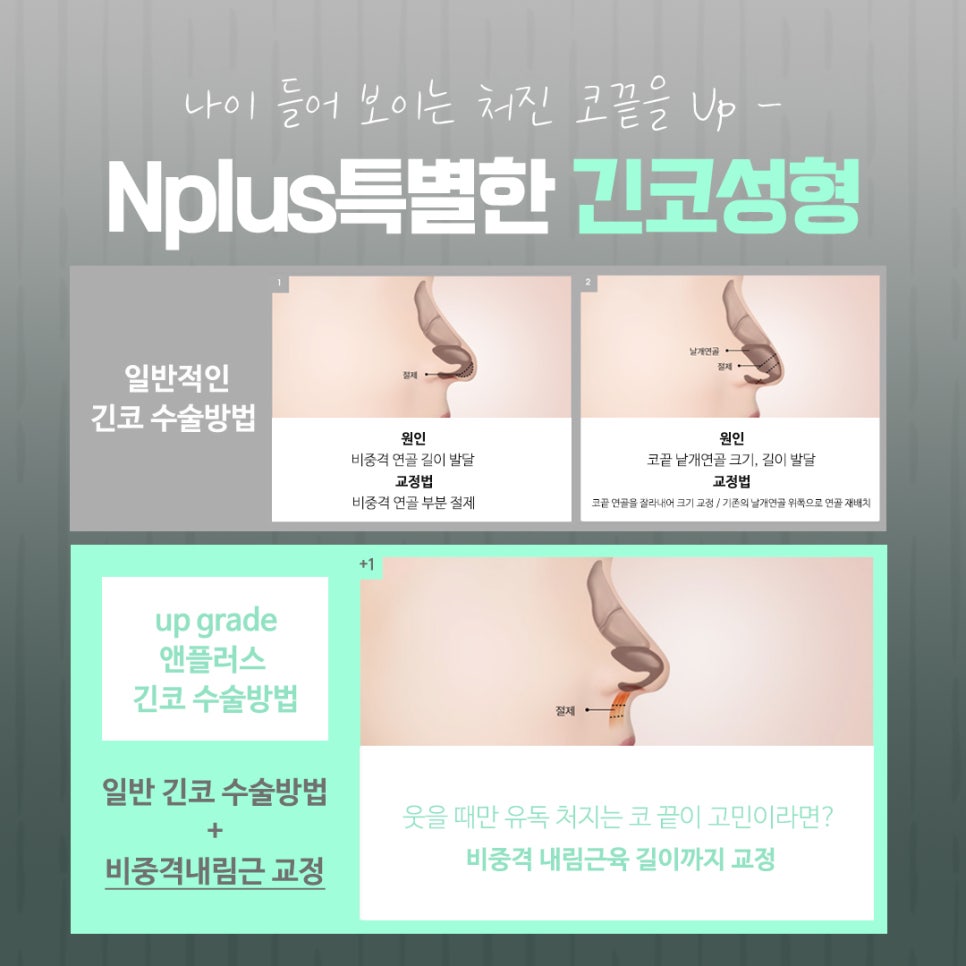 긴코수술을 통해 동안으로 관련 이미지 8