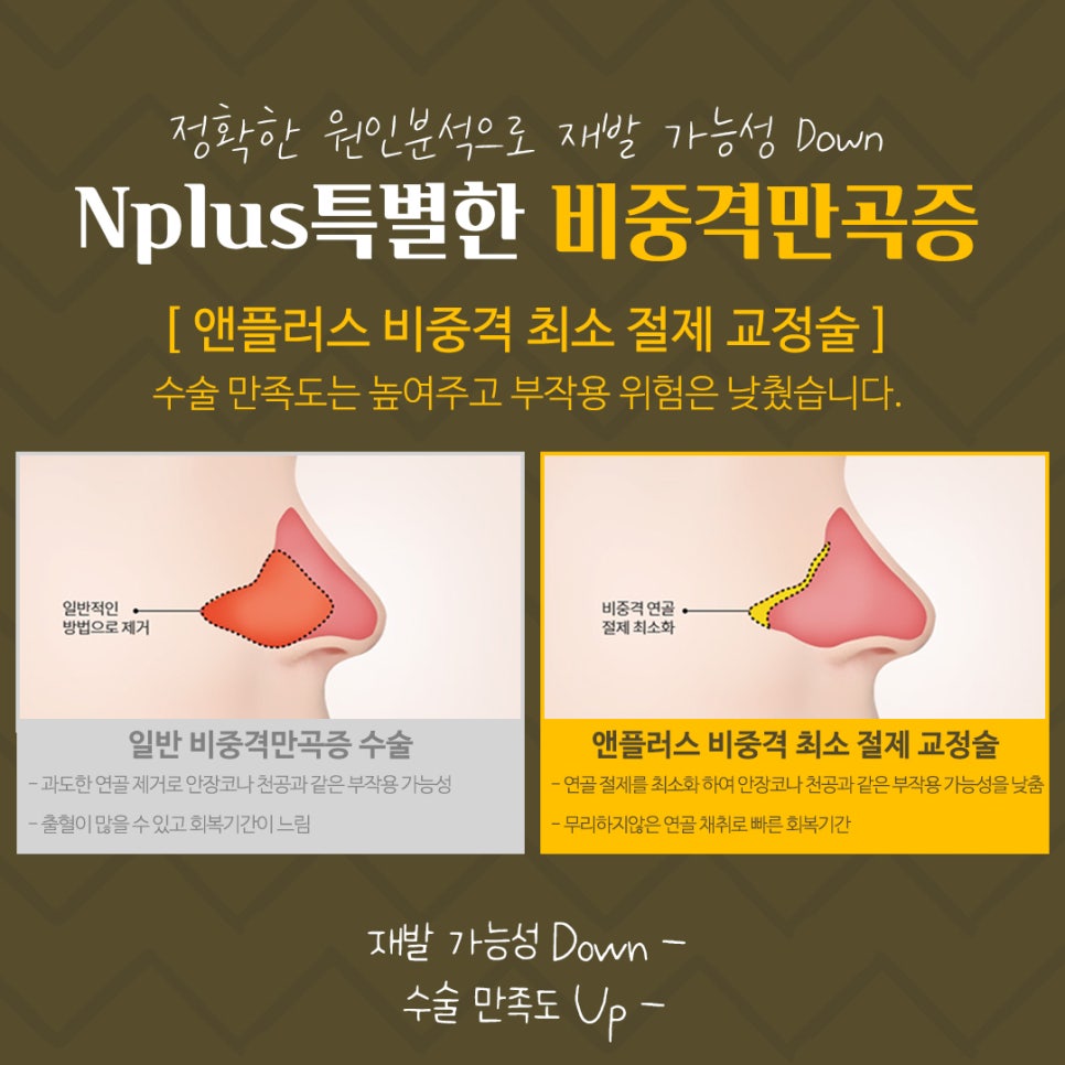 Septoplasty Methods and Causes image 8