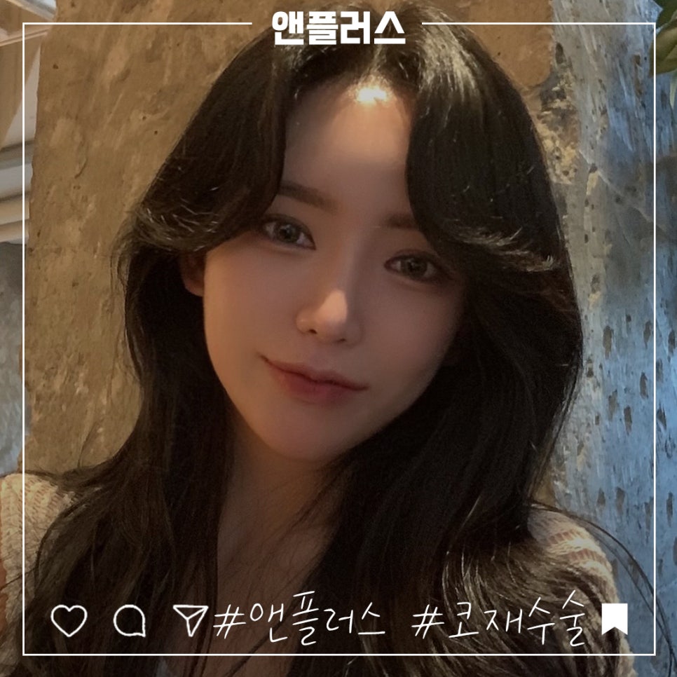 코재수술후기 확실하게 진단하여 관련 이미지 14