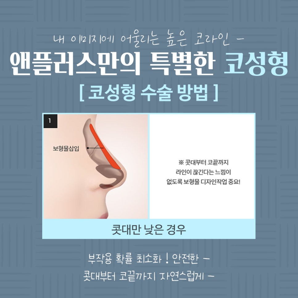코수술전후 기능까지 확인하고 관련 이미지 9