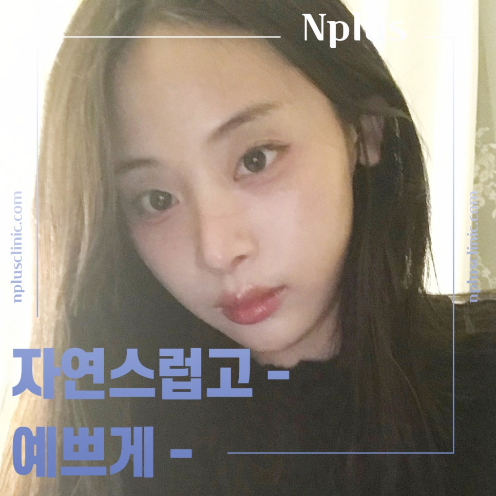 압구정코성형에서 자연스럽게 개선 관련 이미지 4