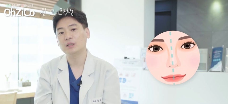 코성형 하면 예쁜코와 효과 없는 코! 관련 이미지 16