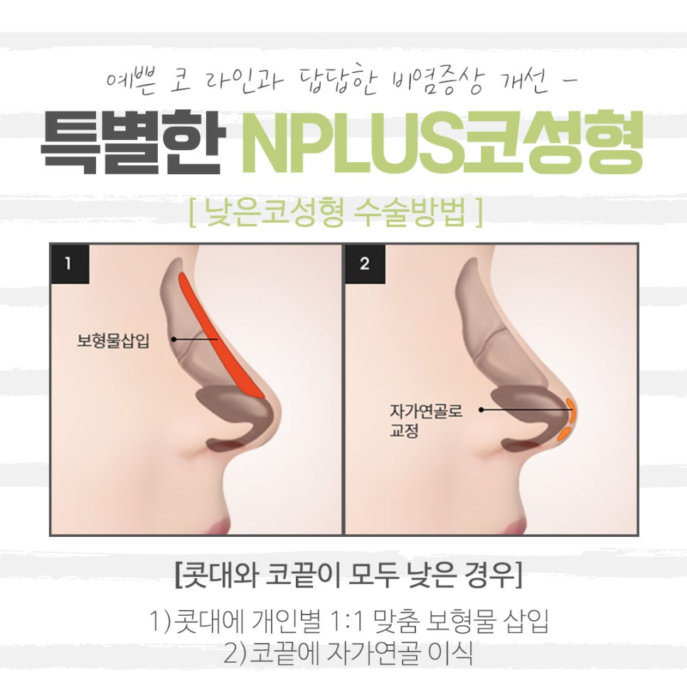 Learn About the Differences in Low Nose Rhinoplasty image 6