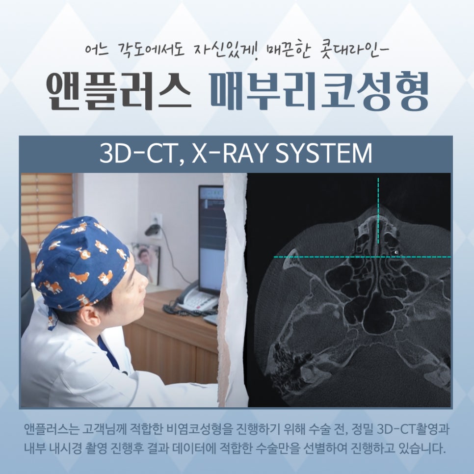 Looking into Cases of Before and After Hump Nose Surgery image 6