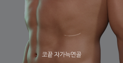 Natural and Satisfying Non-Implant Nose Surgery for Men image 7