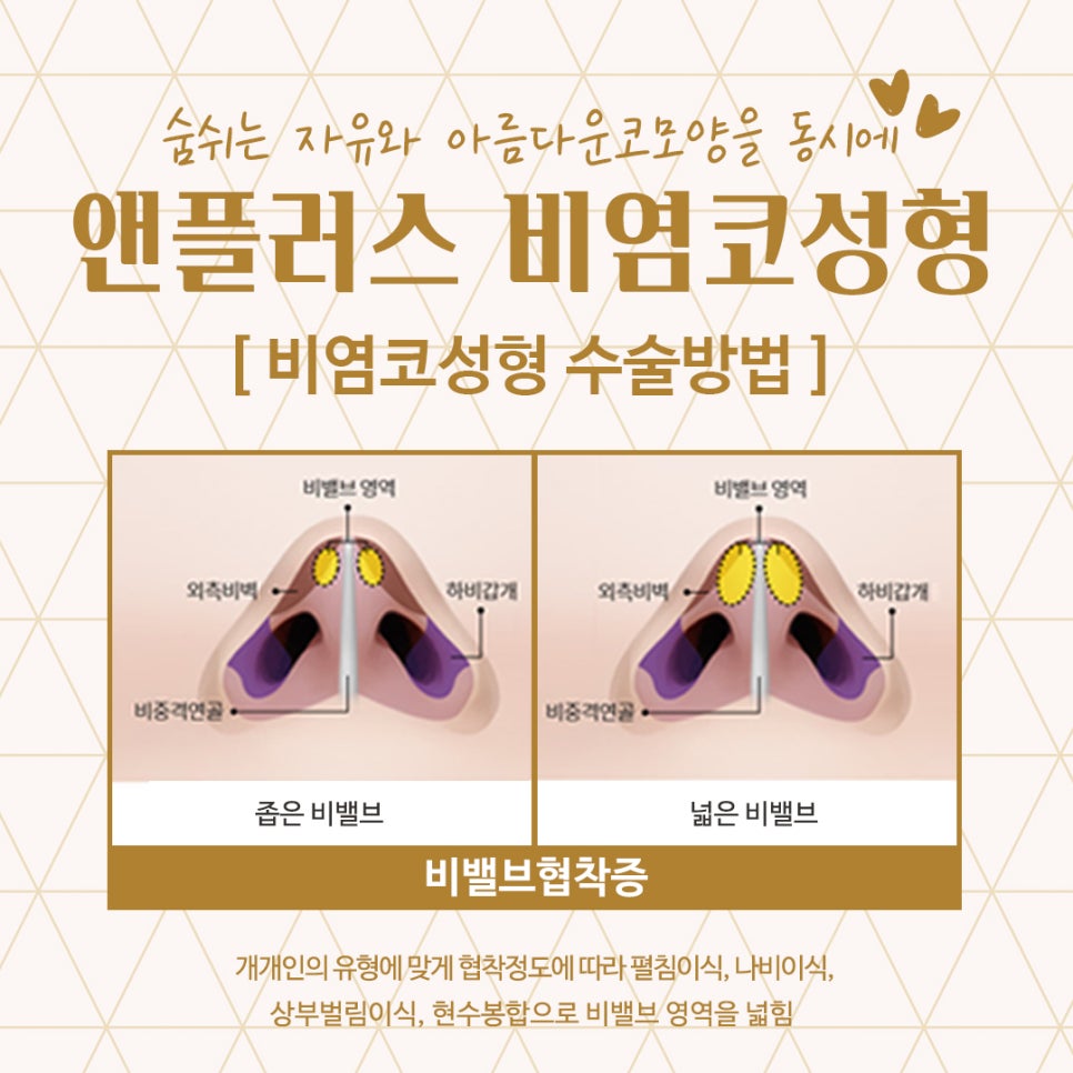 비염코성형후기 예쁜코라인을 생각하면서 관련 이미지 12