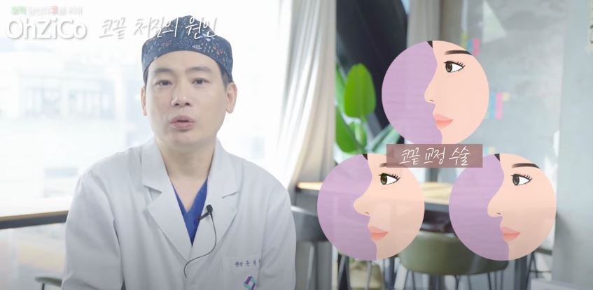 코성형 후 코끝처짐 원인과 해결 방법 관련 이미지 3