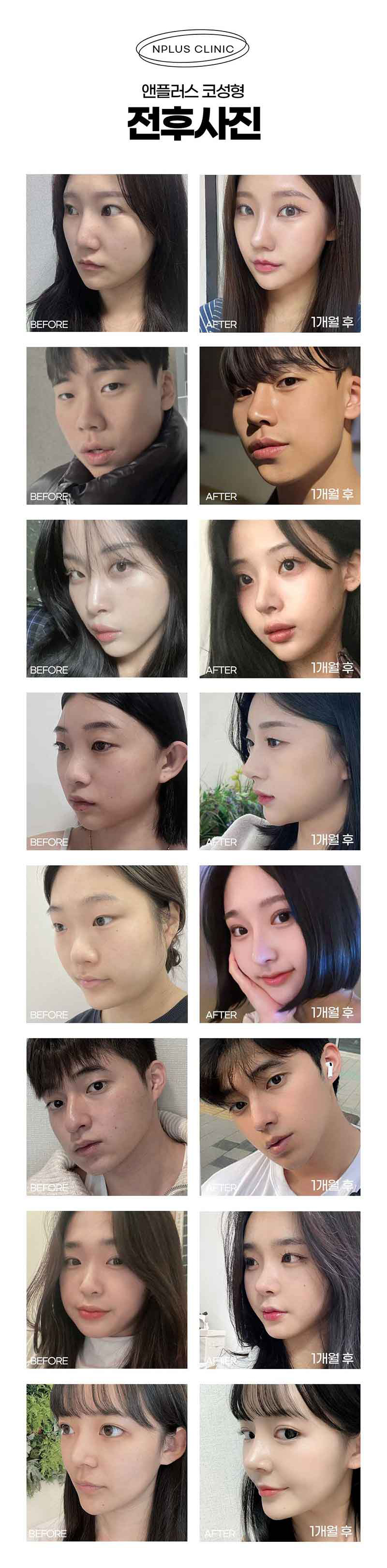코실리콘제거를 통한 불편함 해소 관련 이미지 4
