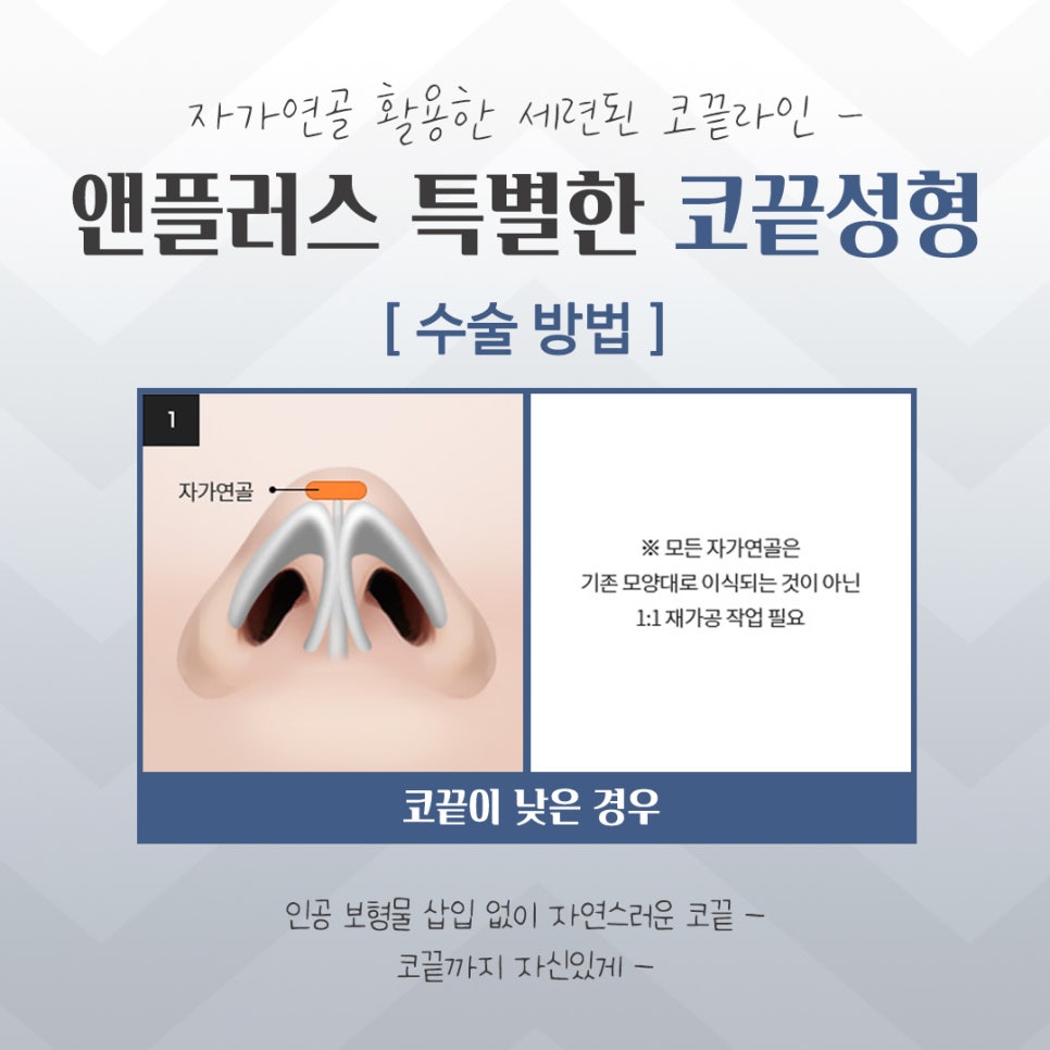 코끝수술후기에 대한 내용을 알아보고 관련 이미지 7