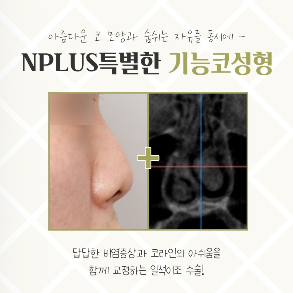 Detailed Information on Functional Rhinoplasty Reviews image 3