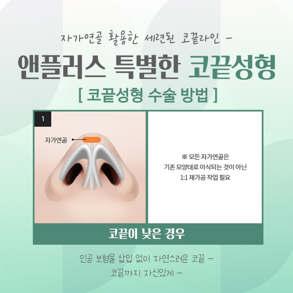 코끝성형후기를 확인하고 자연스럽게 교정하여 관련 이미지 7