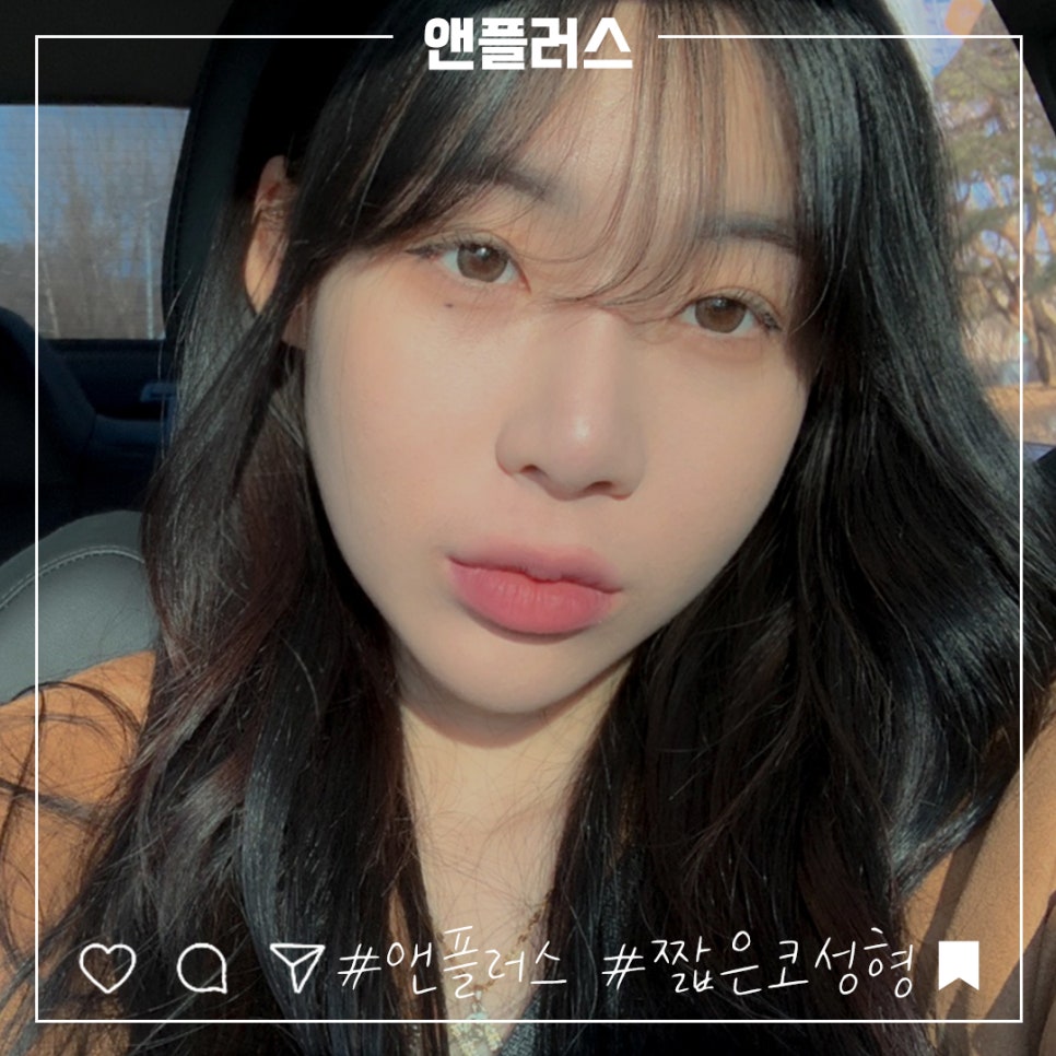 짧은코성형에 대한 차이를 알아보고 관련 이미지 1