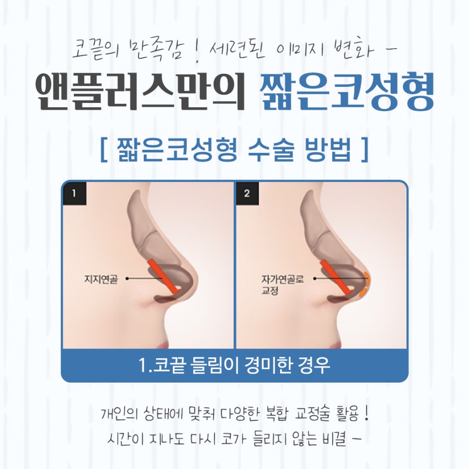 A Beautiful Nose Line with Short Nose Surgery image 8