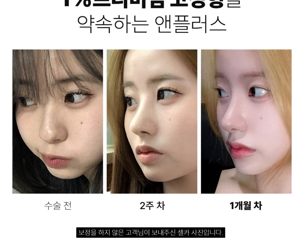 ❤️앤플러스 수험생 코성형 이벤트❤️ 관련 이미지 3