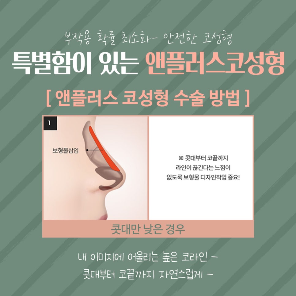 Beautiful and Natural with Autologous Cartilage Rhinoplasty image 9