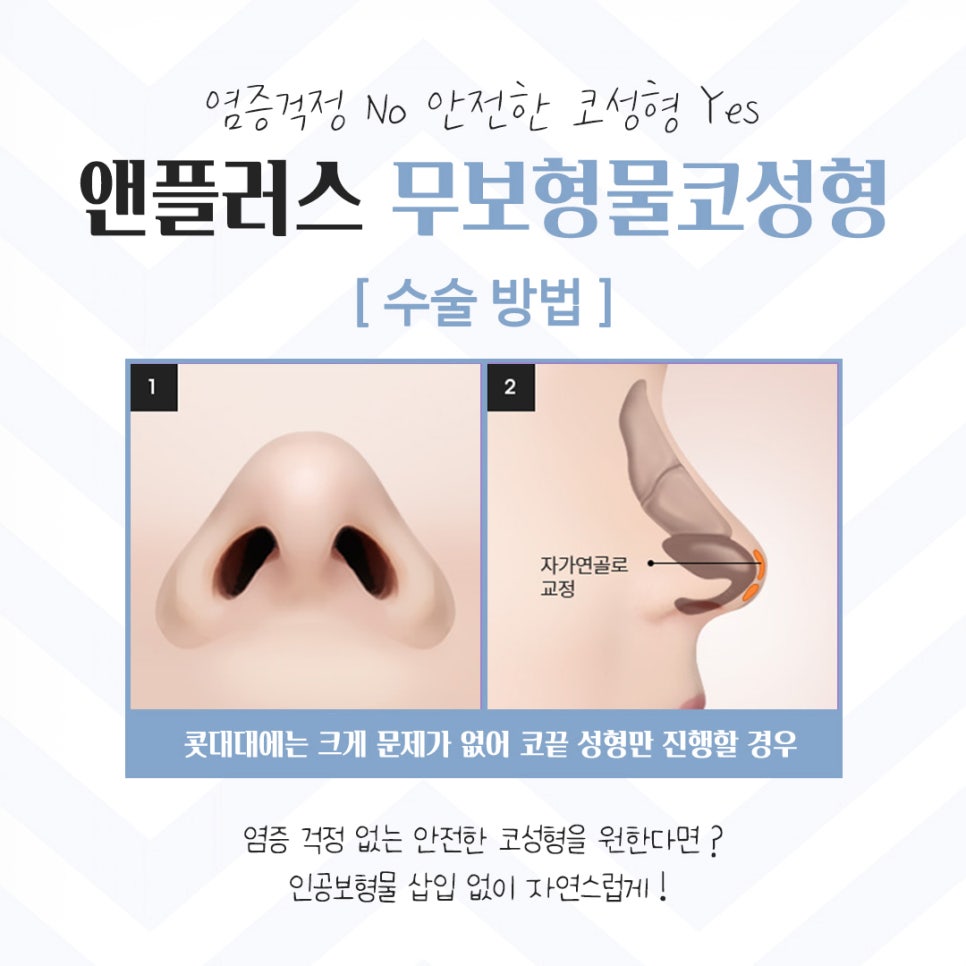 Detailed Information on Non-Implant Rhinoplasty image 9
