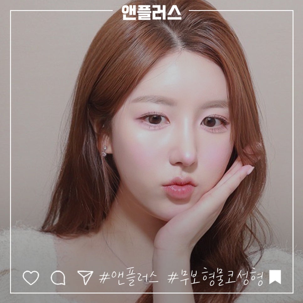 If You’re Looking for Reviews of Non-Implant Nose Surgery image 2