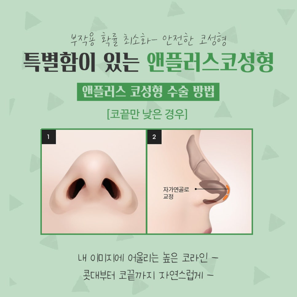 코성형후기 자연스럽고 예쁘게 관련 이미지 10
