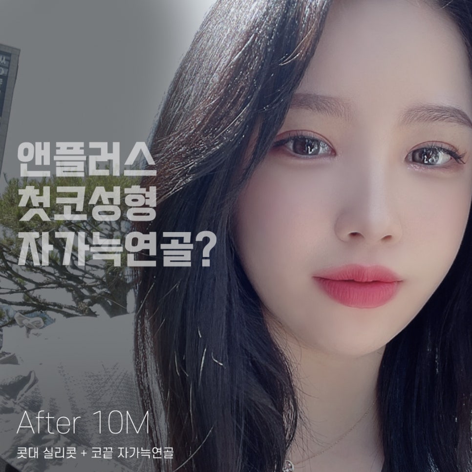 코성형,첫 수술부터 갈비뼈(자가늑연골)로 이식해야 하는 이유 관련 이미지 1