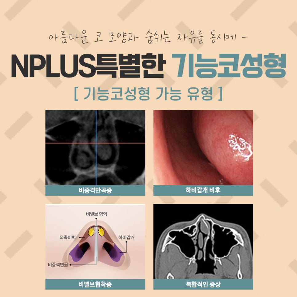 Understanding and Preparing for Functional Rhinoplasty Coverage in Detail image 4