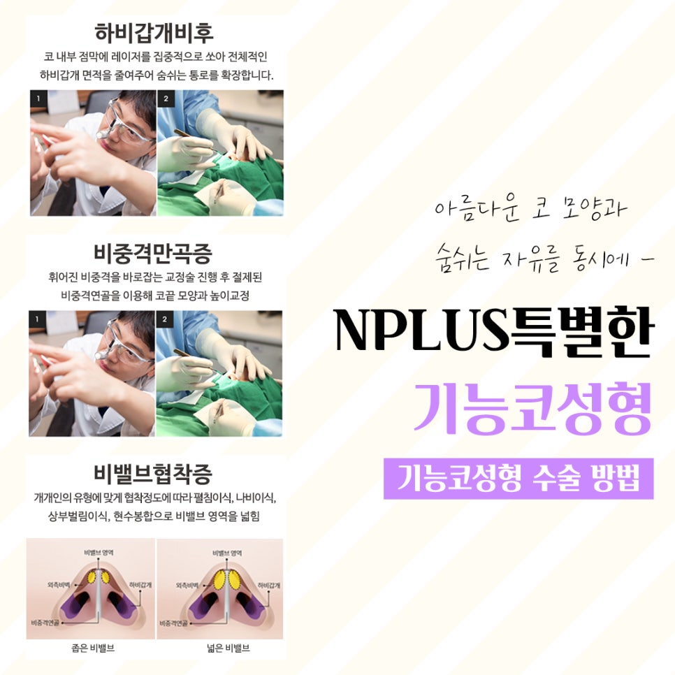 Accurately Reviewing Rhinoplasty Experience image 8
