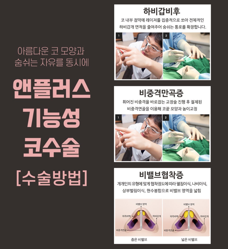 보험이 되는 코성형? 기능성코성형 완벽 정리! 관련 이미지 3