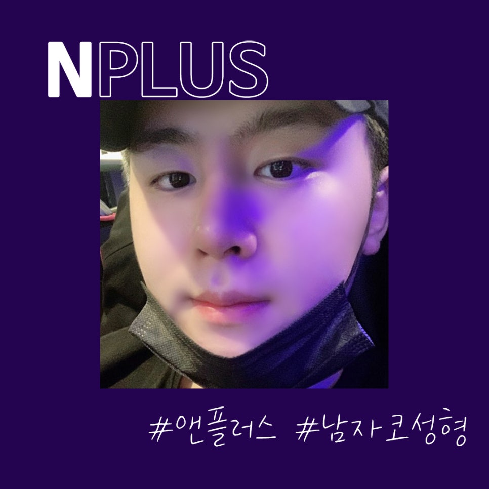 오지코성형외과_남자성형전후 만족스러운 결과 관련 이미지 3