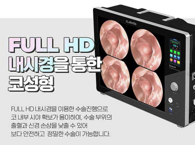 앤플러스의원 자가늑코성형 이벤트😍 관련 이미지 10