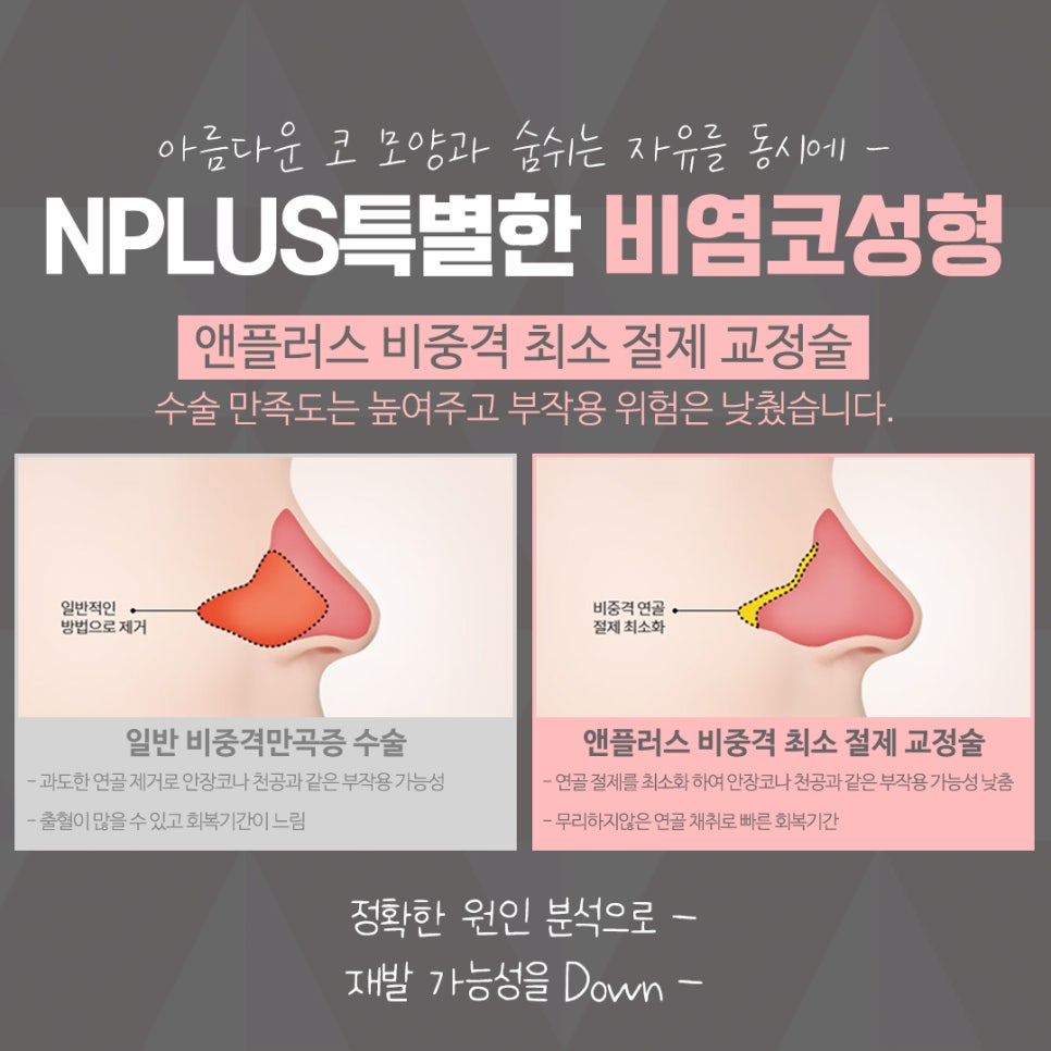 비염의원인 정확하게 진단하여 관련 이미지 8