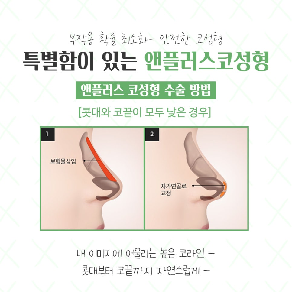 Check Rhinoplasty Reviews for a Natural and Beautiful Result image 8