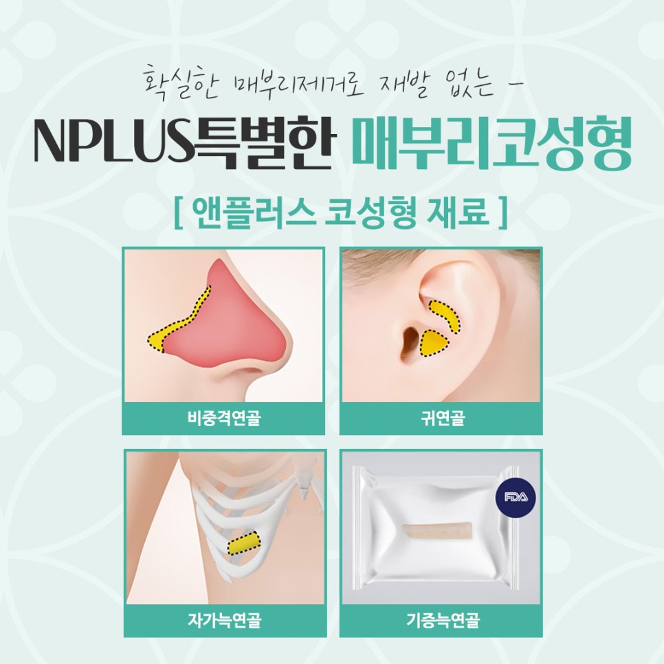 매부리코수술후기 자연스럽고 세련된 라인으로 관련 이미지 11