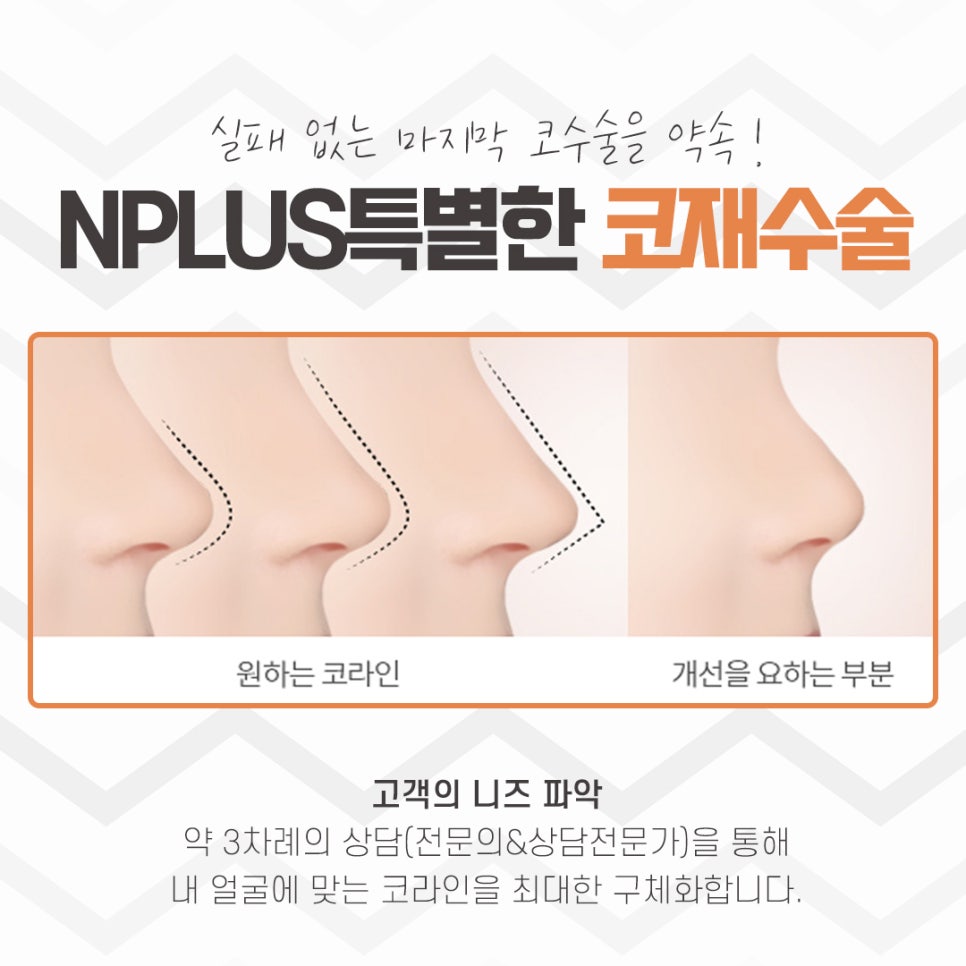 The Importance of Choosing a Revision Rhinoplasty Review image 3