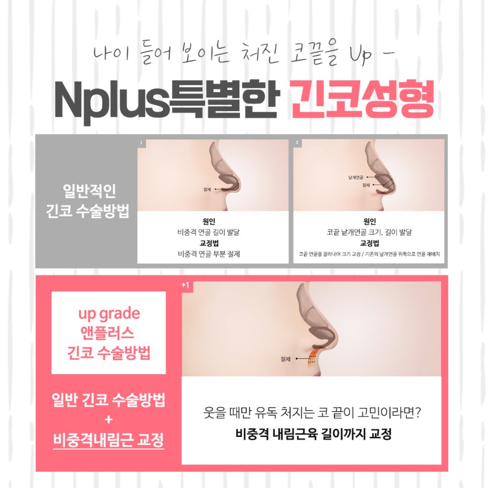 긴코성형 후기까지 알아보고 관련 이미지 7