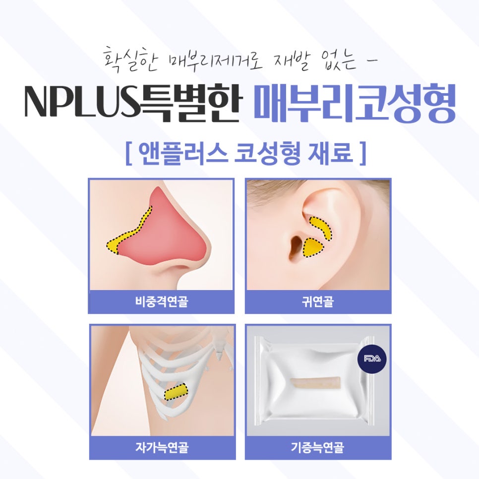 Learn About Hump Nose Surgery Reviews Accurately image 12
