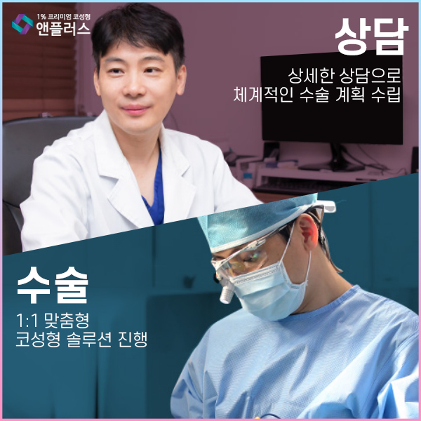 Crooked Nose Surgery at N+ image 9