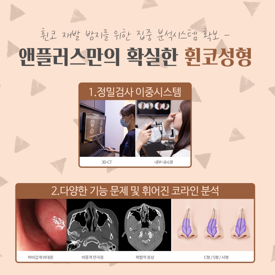 Crooked Nose Surgery Review, Including Functional Improvement image 7