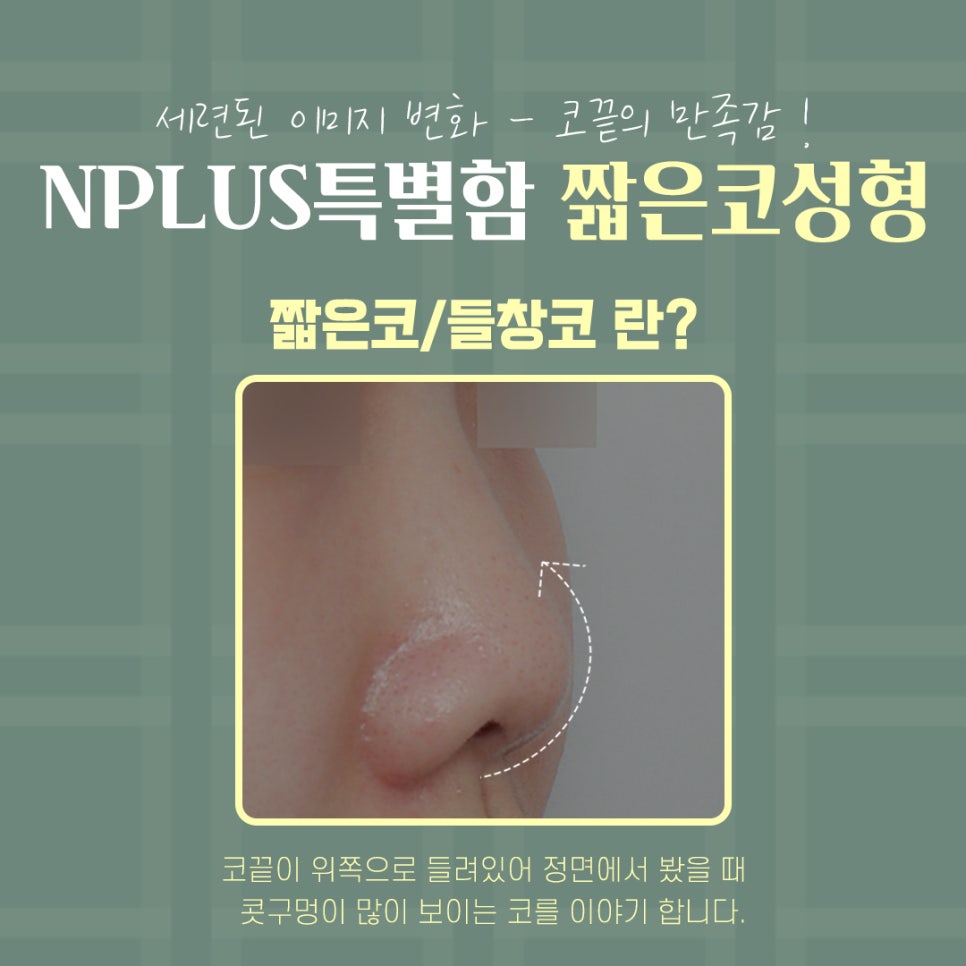 Considering the Line in Reviews of Low, Short Nose Surgery image 4