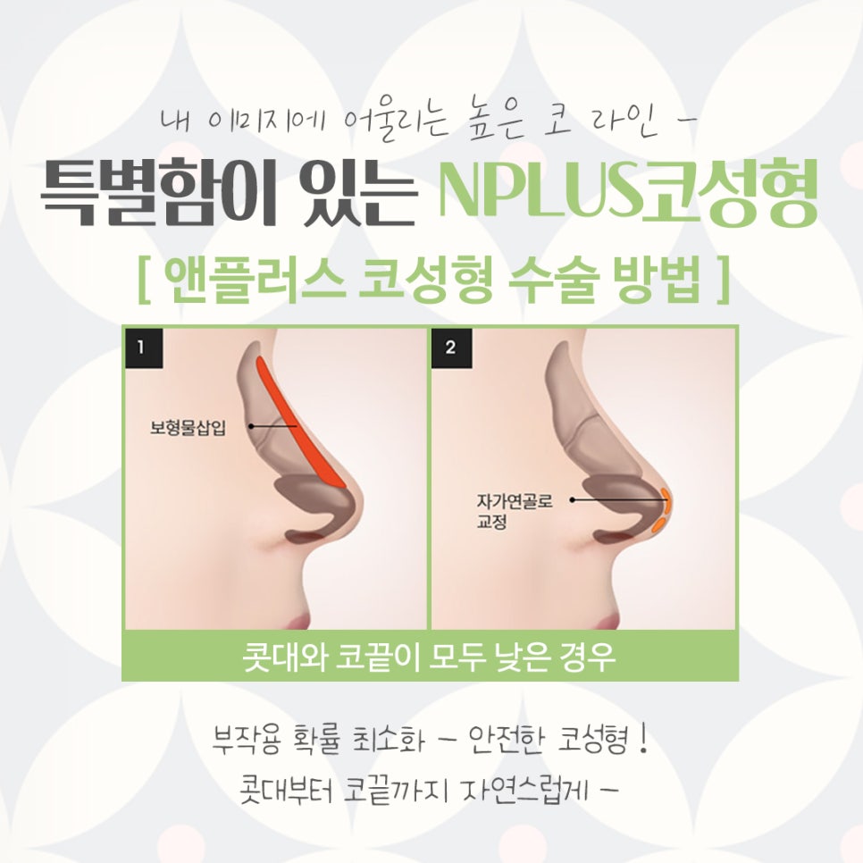 코수술잘하는곳에서 예쁘고 자연스럽게 관련 이미지 9